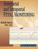 Michelle Murray Antepartal And Intrapartal Fetal Monitoring 0003 Edition; 