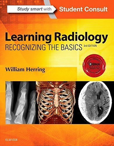 William Herring Learning Radiology Recognizing The Basics 0003 Edition;revised 