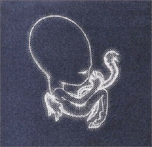 Sigur Ros/Agaetis Byrjun