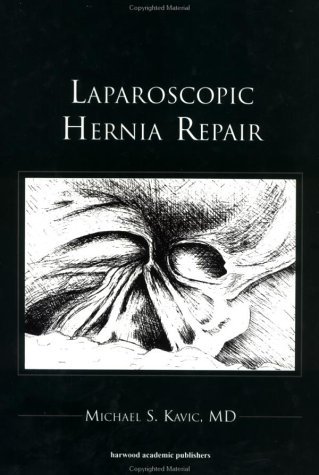 Michael S. Kavic Laparoscopic Hernia Repair 