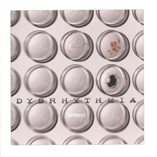 Dysrhythmia/Pretest