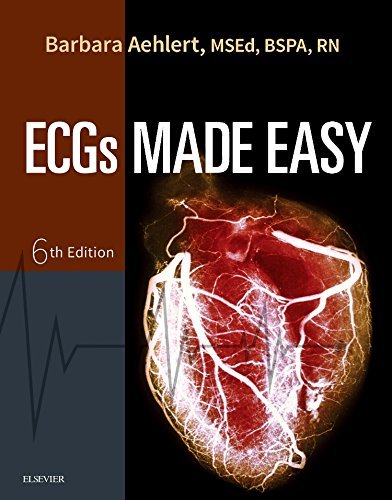 Barbara J. Aehlert Ecgs Made Easy 0006 Edition; 