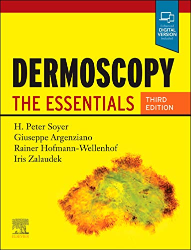 H. Peter Soyer Dermoscopy The Essentials 0003 Edition; 