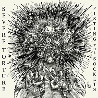 Severe Torture/Fisting The Sockets