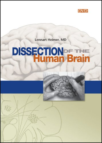 Dissection Of The Human Brain/Dissection Of The Human Brain