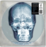 King Gizzard & The Lizard Wizard/Skull X-Ray (DELUXE EDITION)