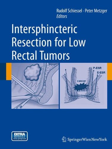 Rudolf Schiessel/Intersphincteric Resection for Low Rectal Tumors@2012