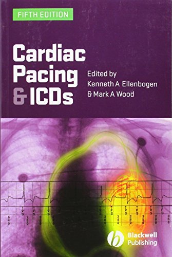 Ellenbogen Kenneth A. Ed. Cardiac Pacing And Icds 0005 Edition; 